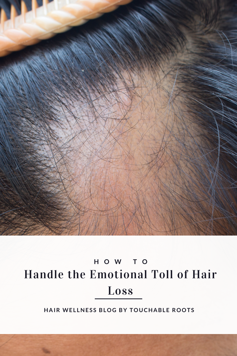 How to Handle the Emotional Toll of Hair Loss